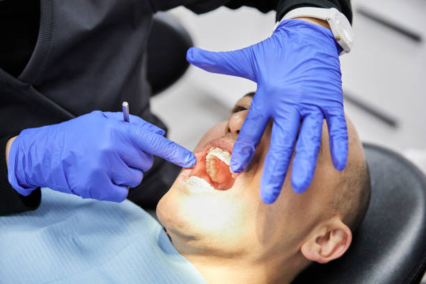 Best Emergency Broken Tooth Repair in Tarrant, AL